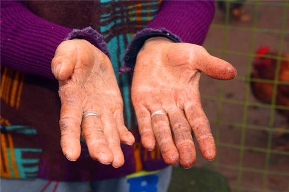 李德碧满是厚茧的双手.通讯员 赵武强 摄